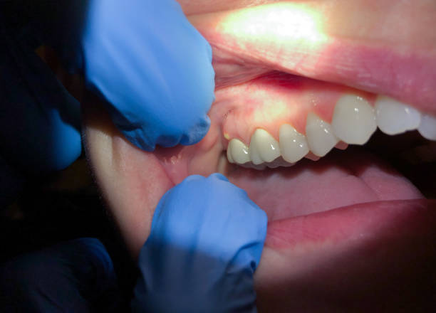 Best Emergency Gum Pain Relief  in Bainbridge, OH